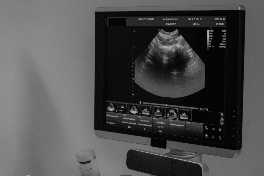 Ultra Sound Scan