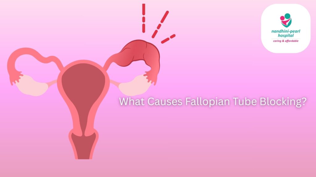 Top Causes of Blocked Fallopian Tubes and How to Prevent Them