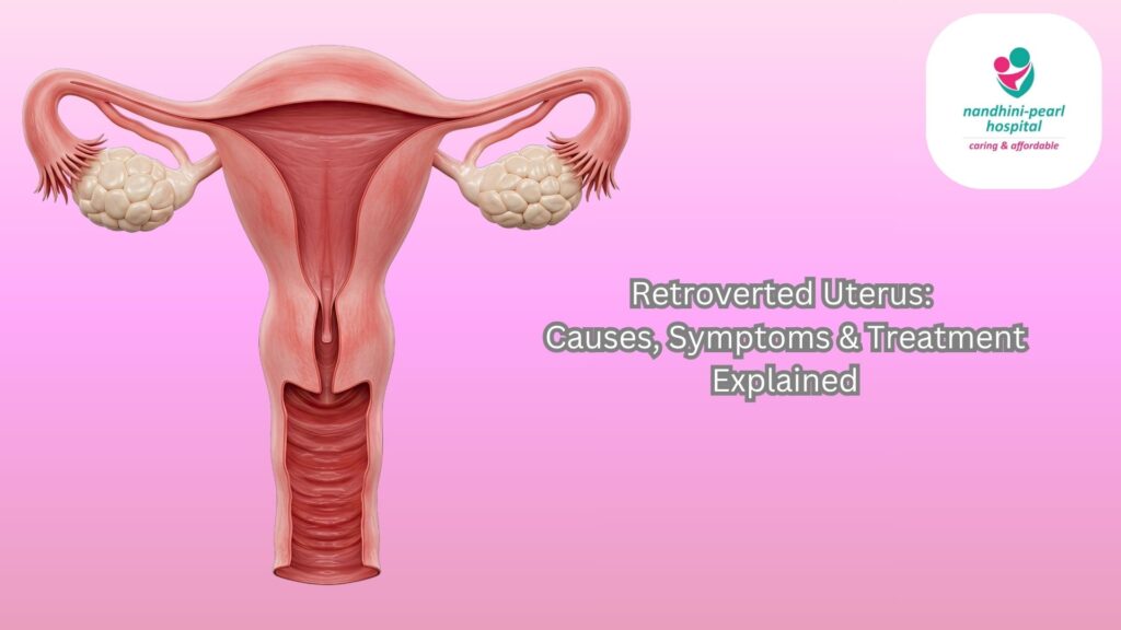 What Is a Retroverted Uterus? Symptoms, Fertility & Pregnancy Facts