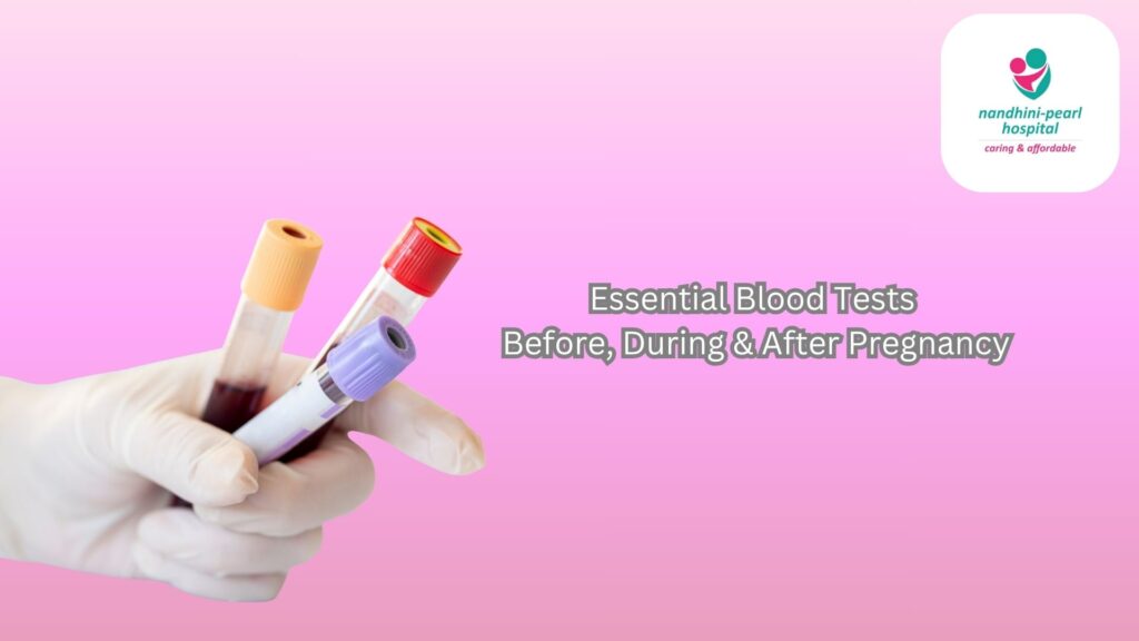 A gloved hand holding blood sample tubes, representing essential blood tests before, during, and after pregnancy at Nandhini-Pearl Hospital, Velachery.