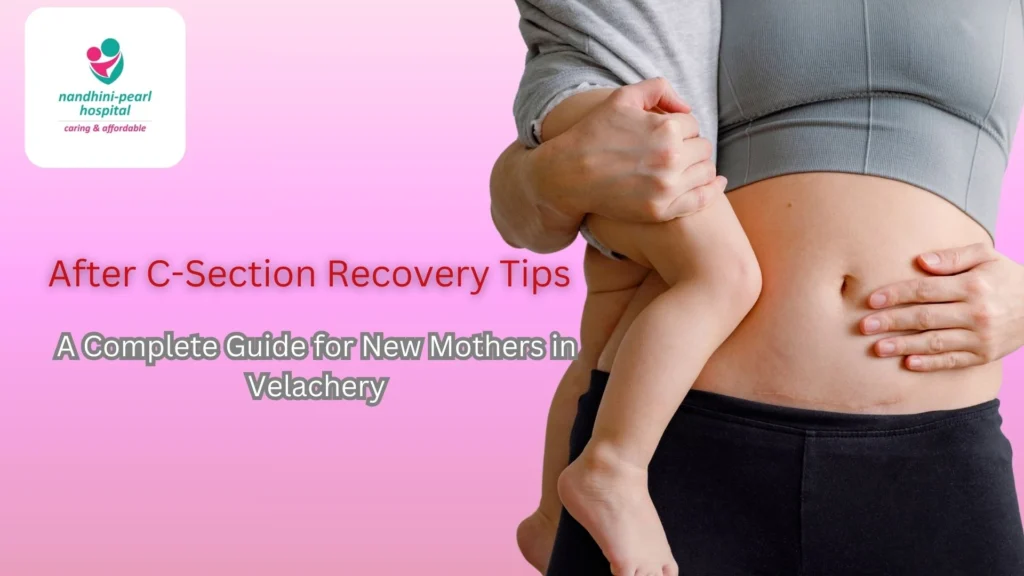 After C-Section Recovery Tips: A Complete Guide for New Mothers in Velachery